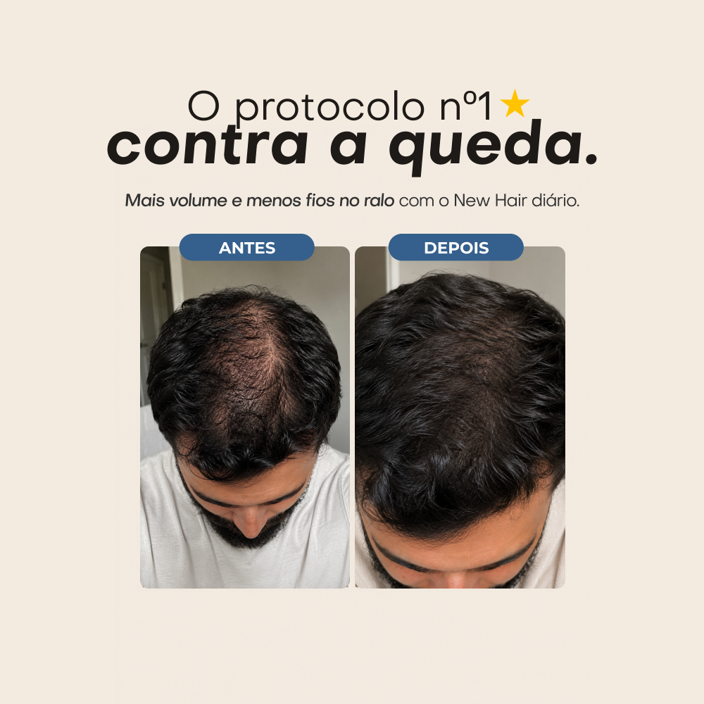 Vitamina para homens: Barba, cabelo e pele | New Hair