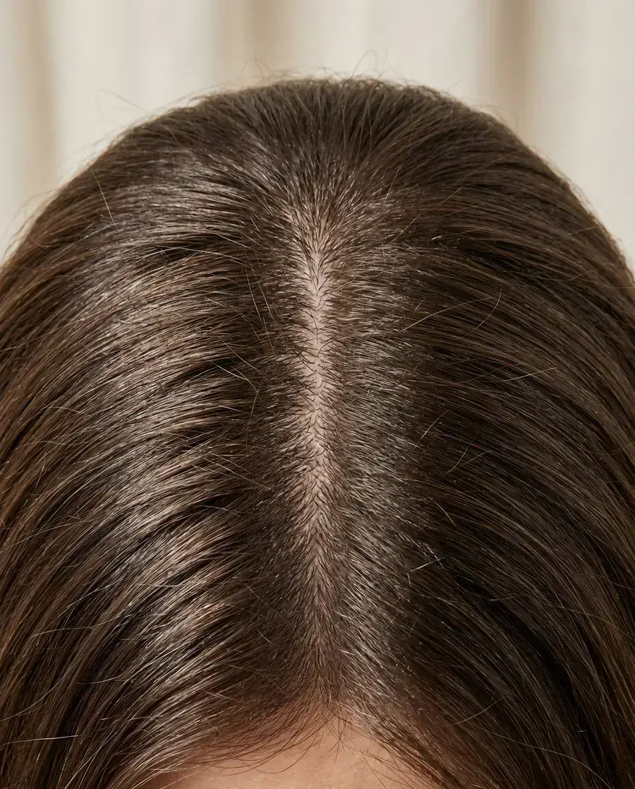 Marina, 42 anos, depois